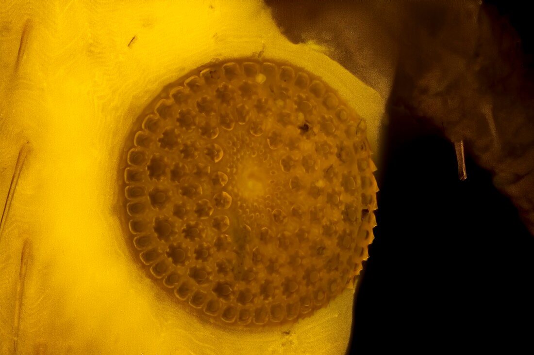 Tick spiracle, light micrograph