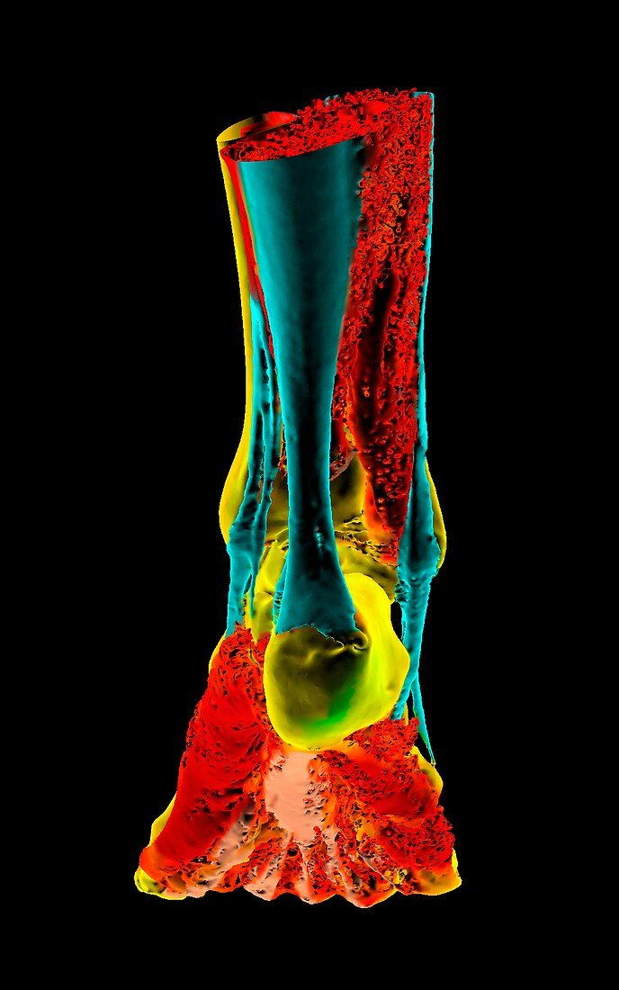 Human foot and Achilles tendon, 3D CT scan