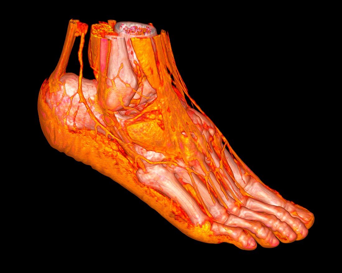 Human ankle and foot, 3D CT scan