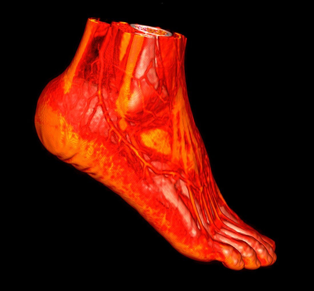 Human ankle and foot, 3D CT scan
