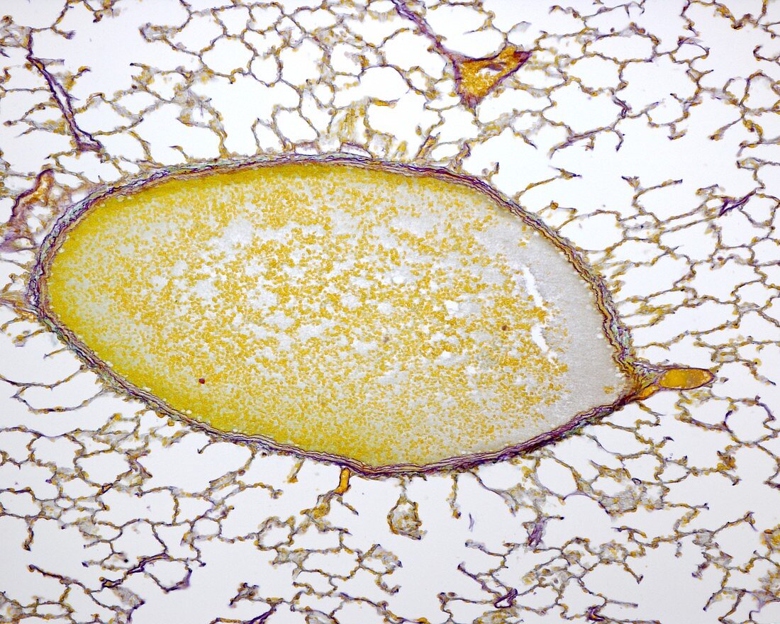 Pulmonary vein, light micrograph