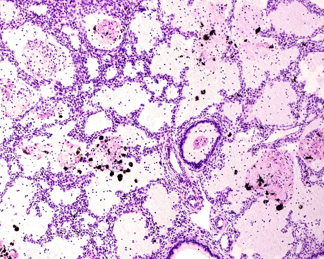 Immature lung, light micrograph