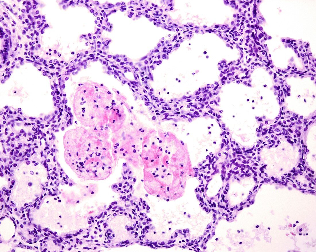 Immature lung, light micrograph