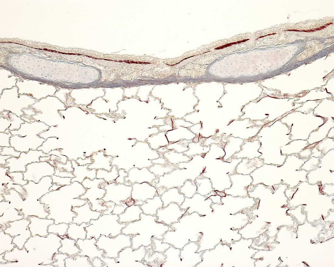 Immature lung, light micrograph