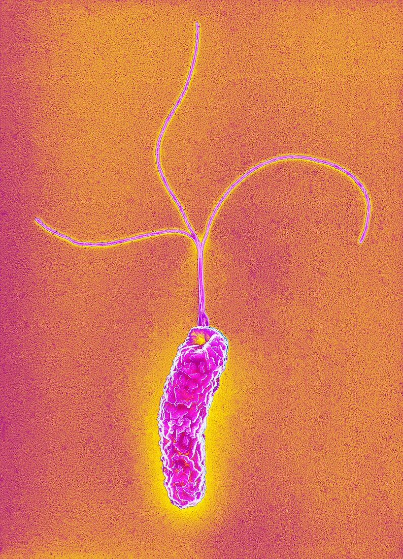 Helicobacter pylori bacterium, SEM