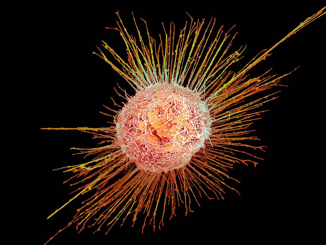 Lung cell infected with H1N1 flu virus, SEM