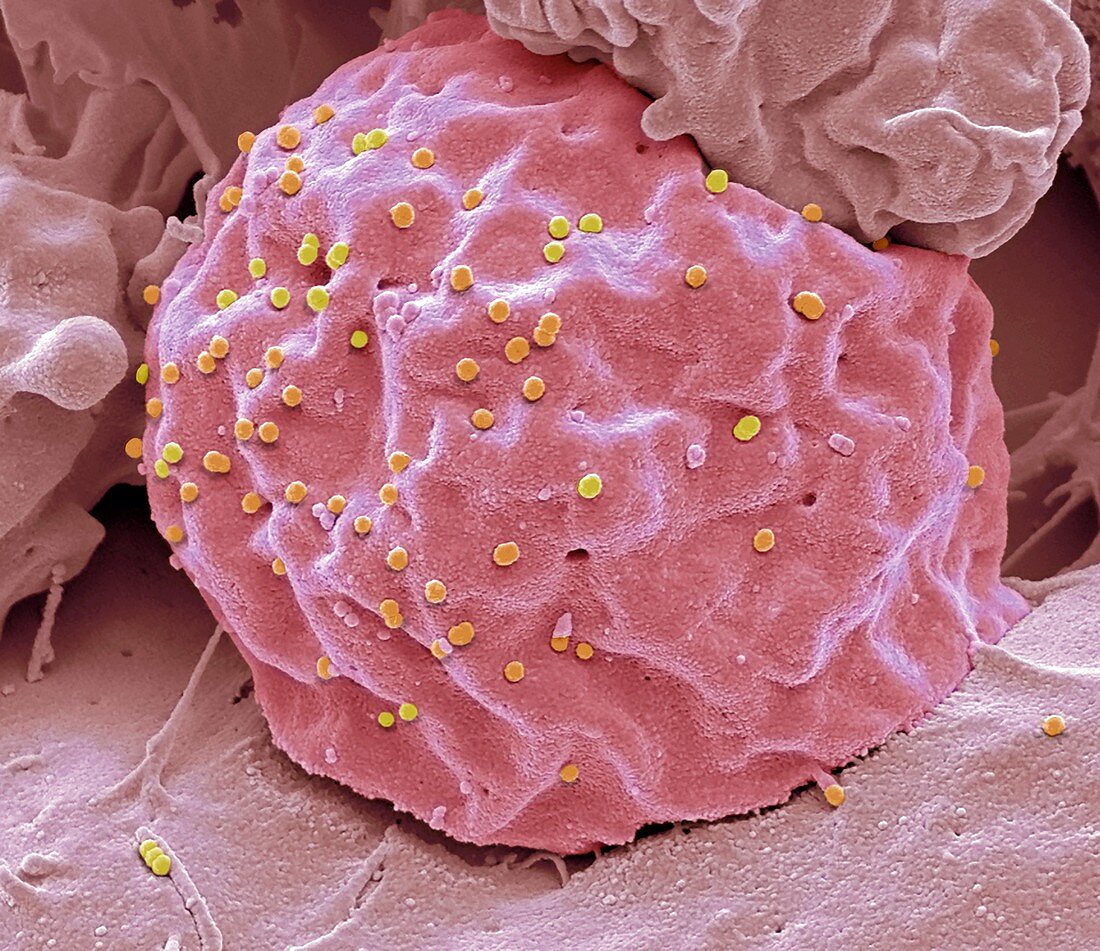 HIV viral vector, SEM