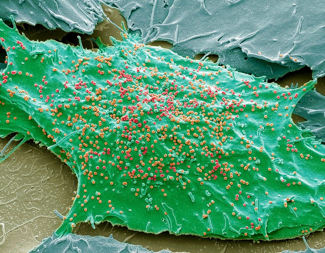 SIV infected cells, SEM