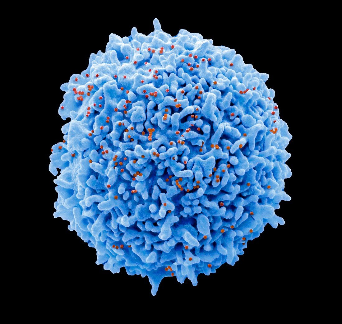 T-cell infected with HIV, SEM