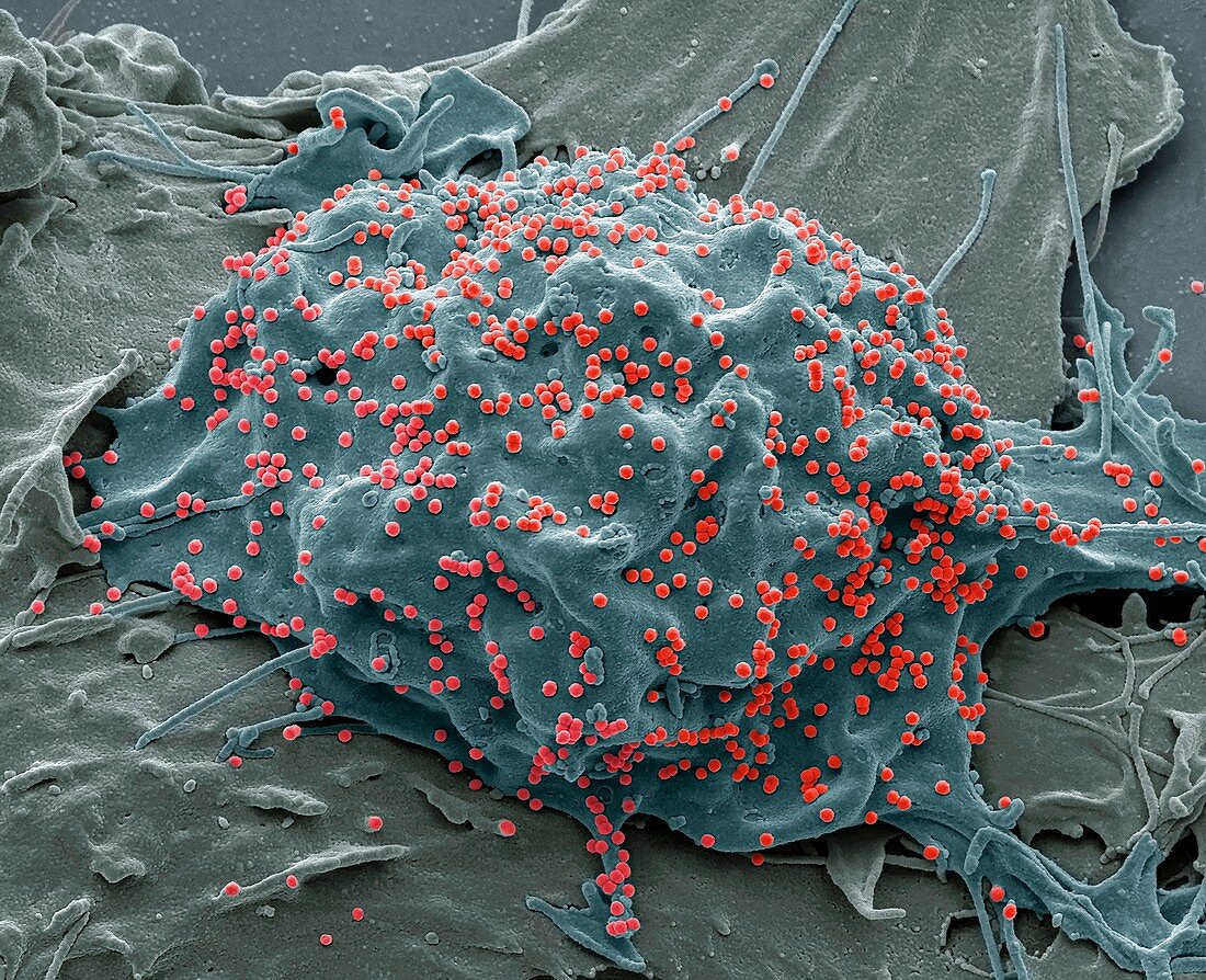 SIV infected cells, SEM