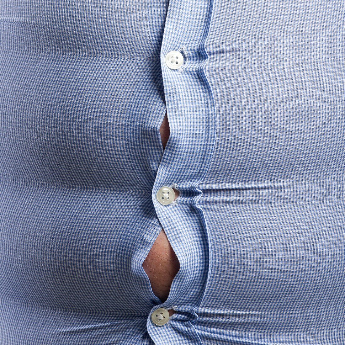 Overweight man with bulging shirt buttons