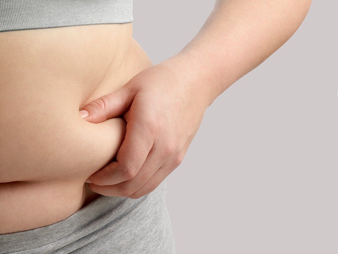 Overweight woman holding body fat