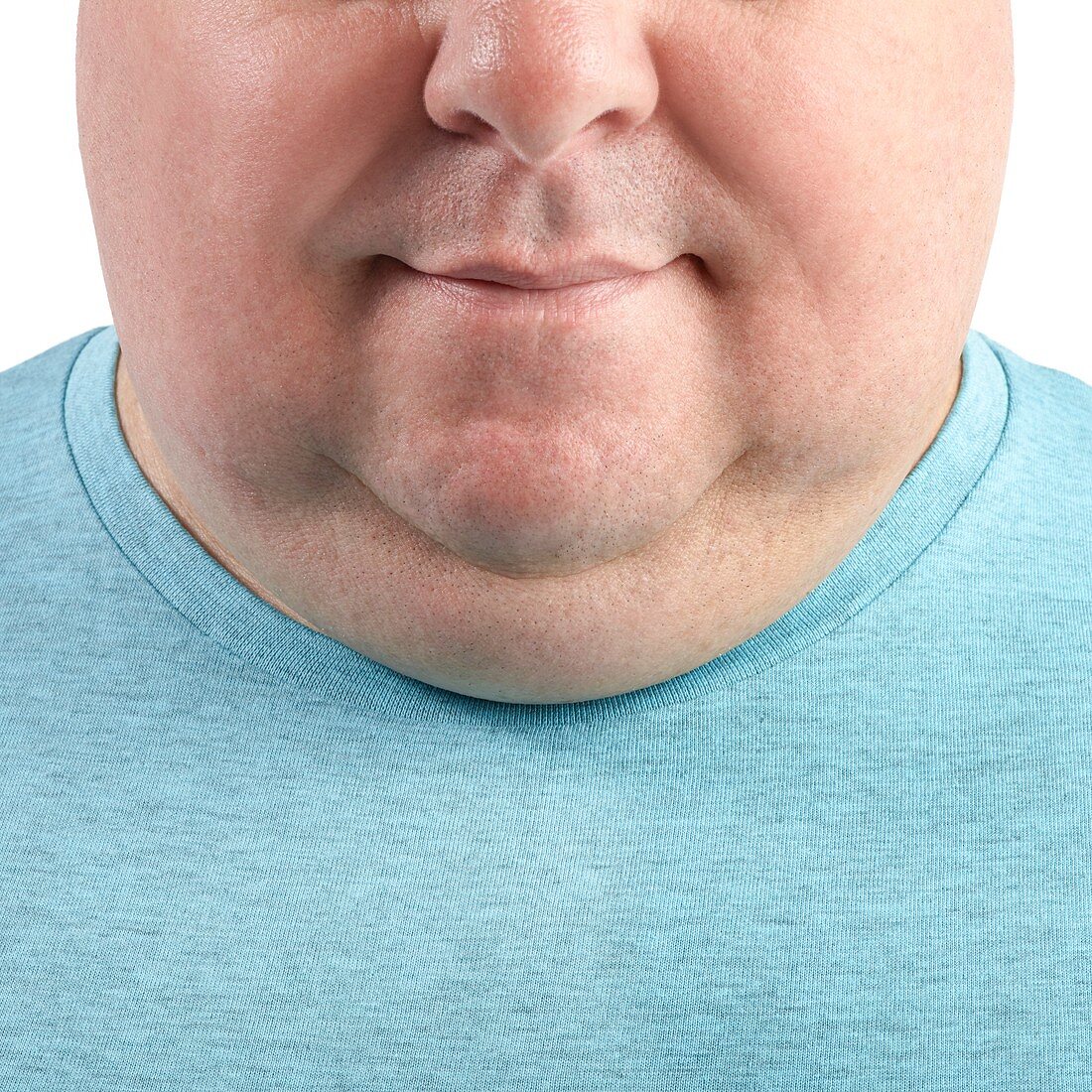 Overweight man's chin and neck