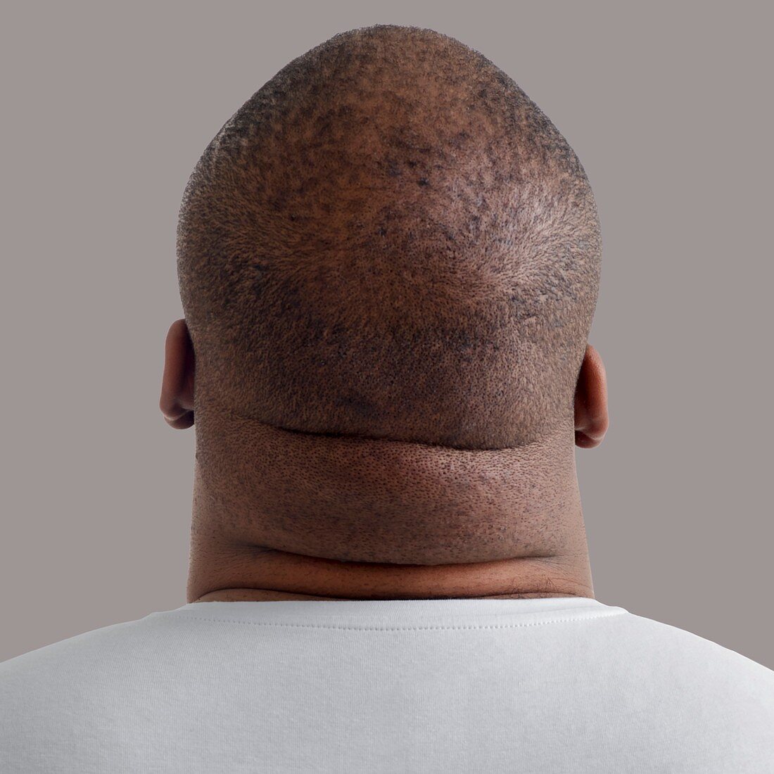 Close up of overweight man's neck