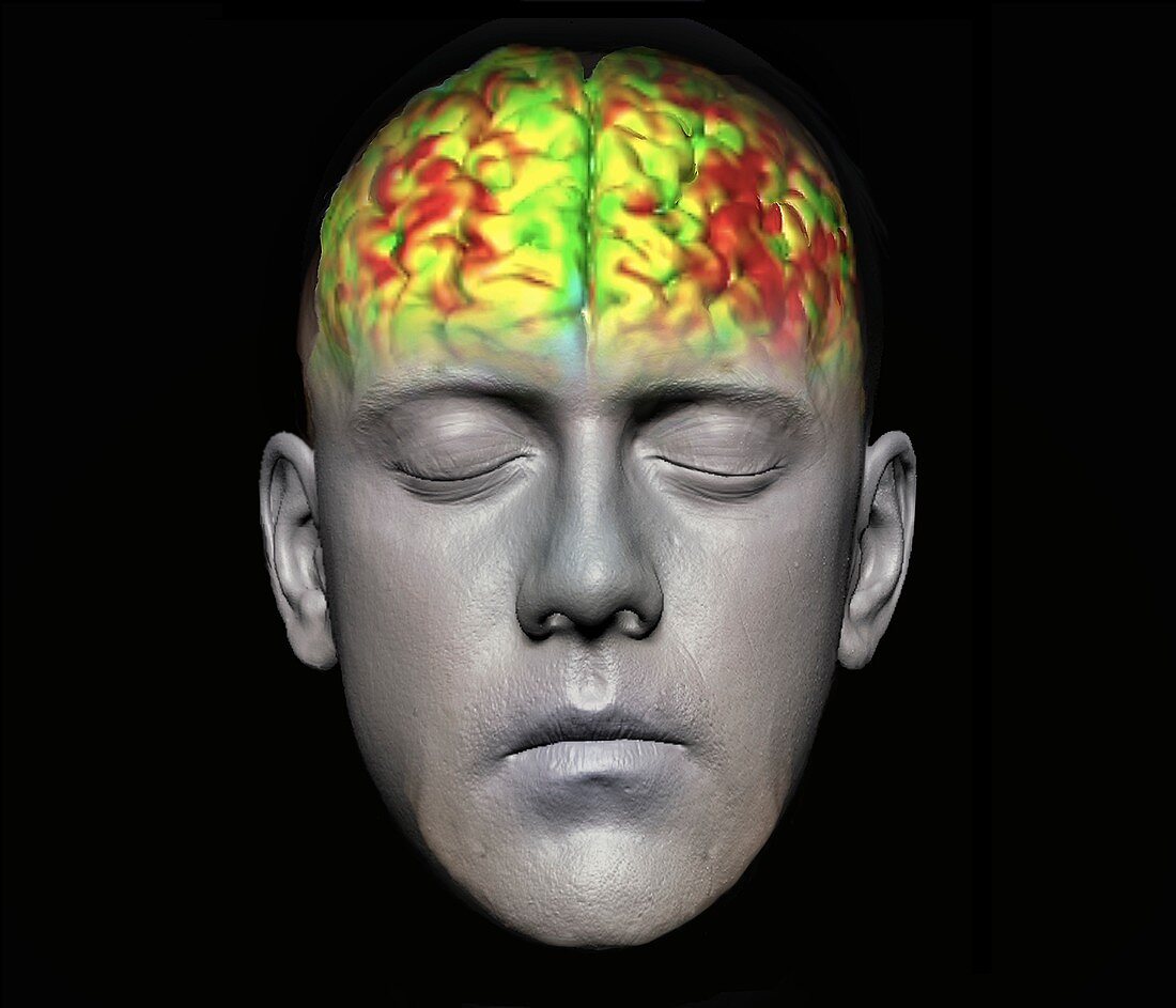 Human brain, fMRI scan