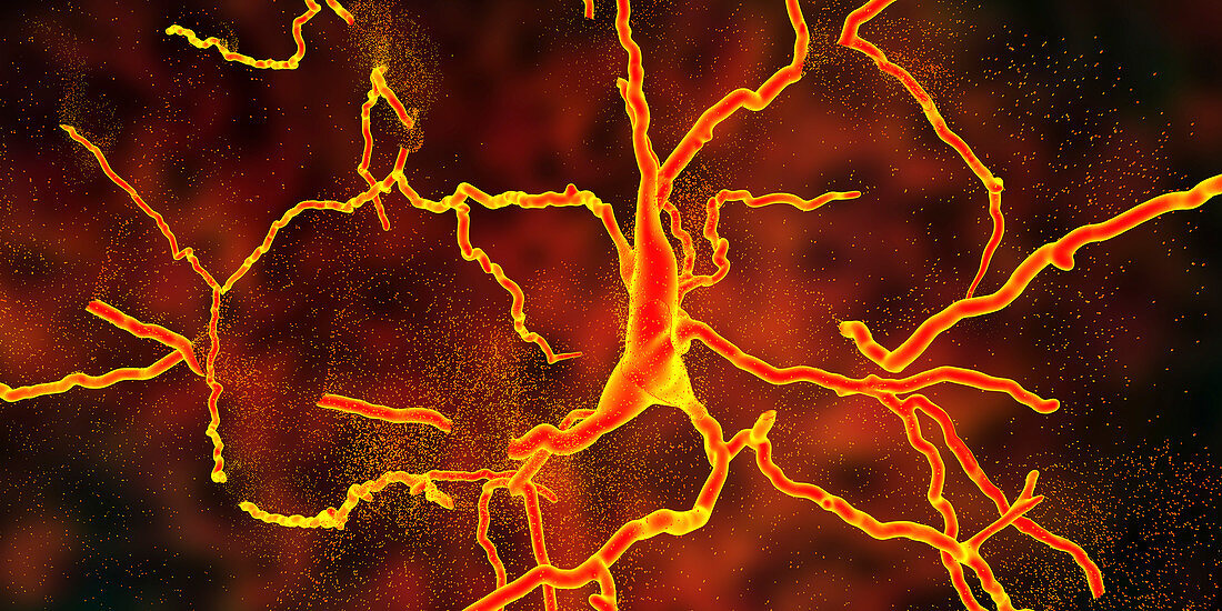 Degeneration of a neuron, conceptual illustration