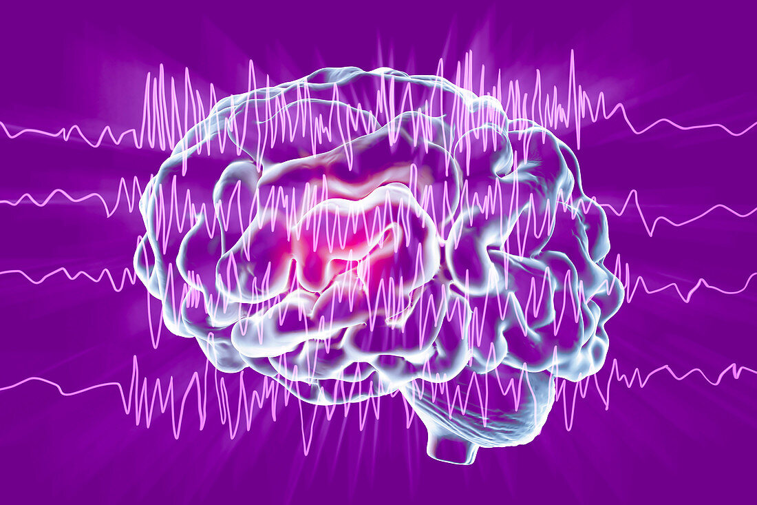 Brain and brain waves in epilepsy, illustration