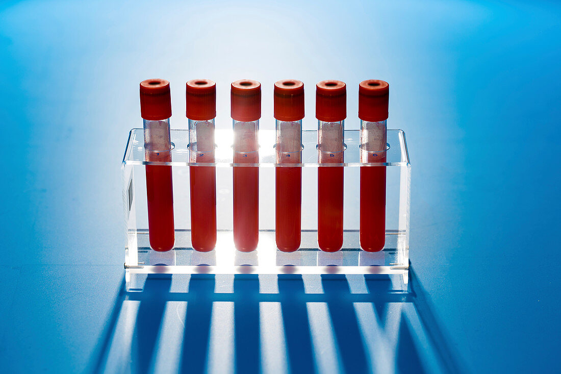 Blood samples in a lab