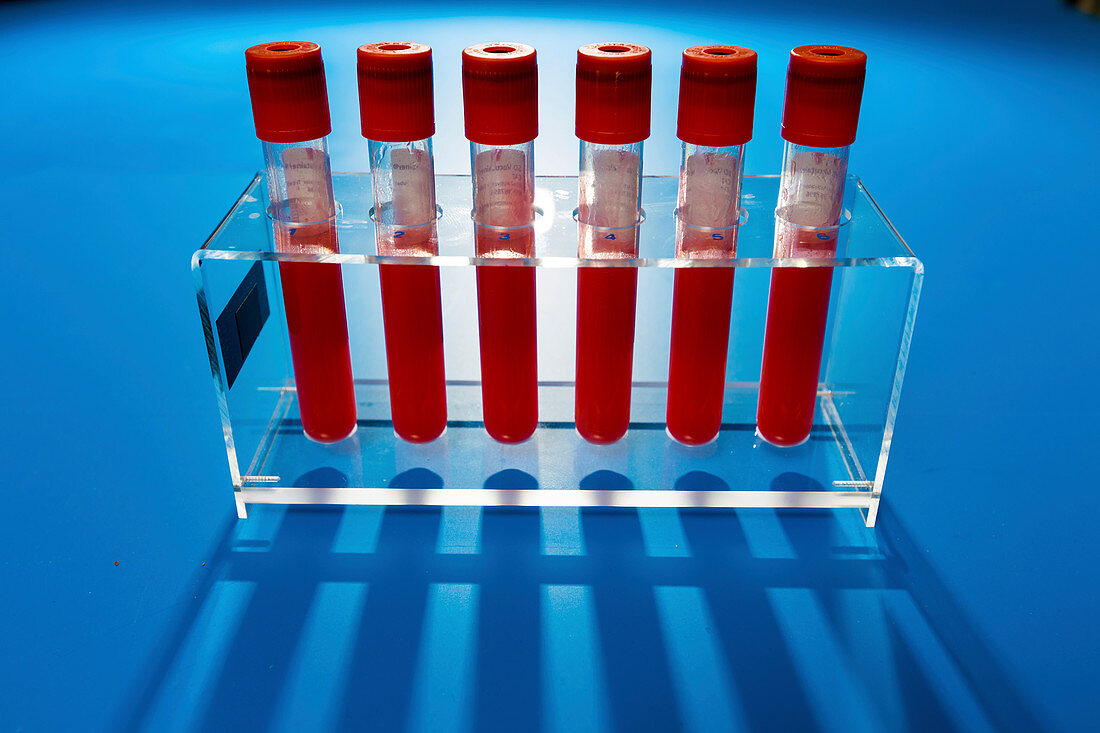 Blood samples in a lab