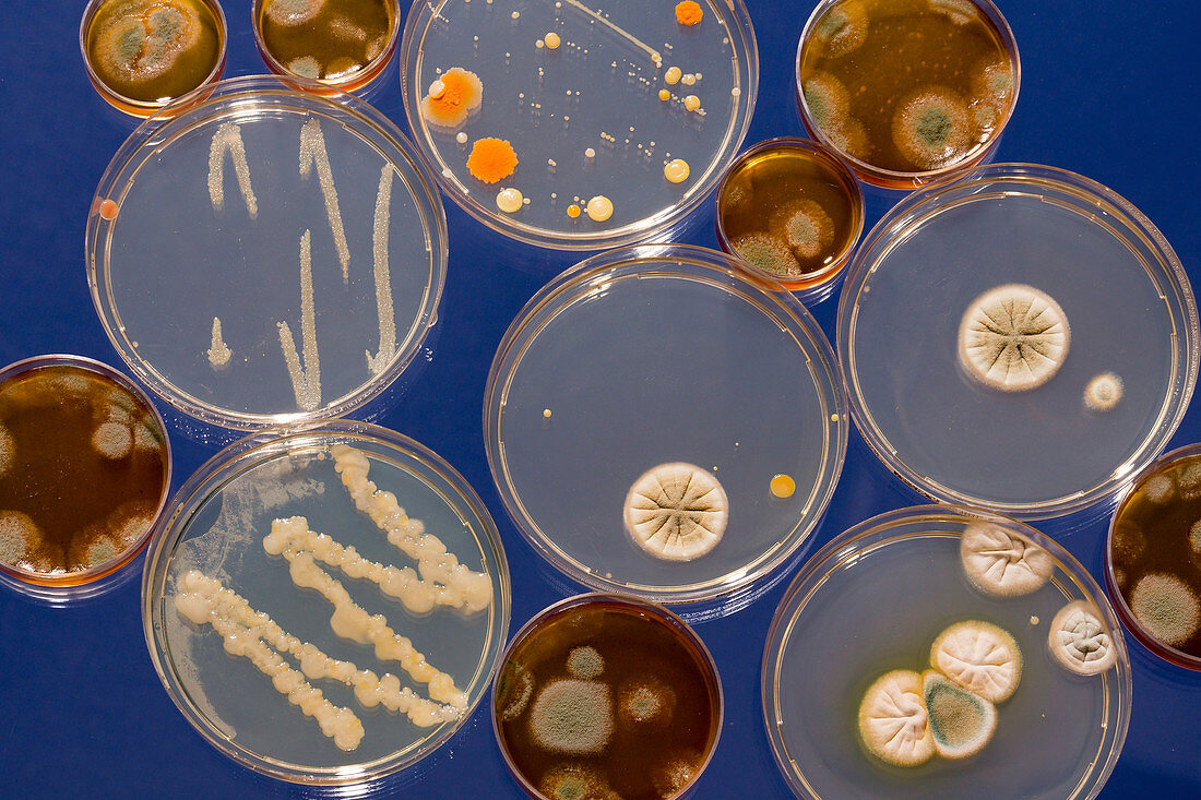 Cultures growing on Petri dishes