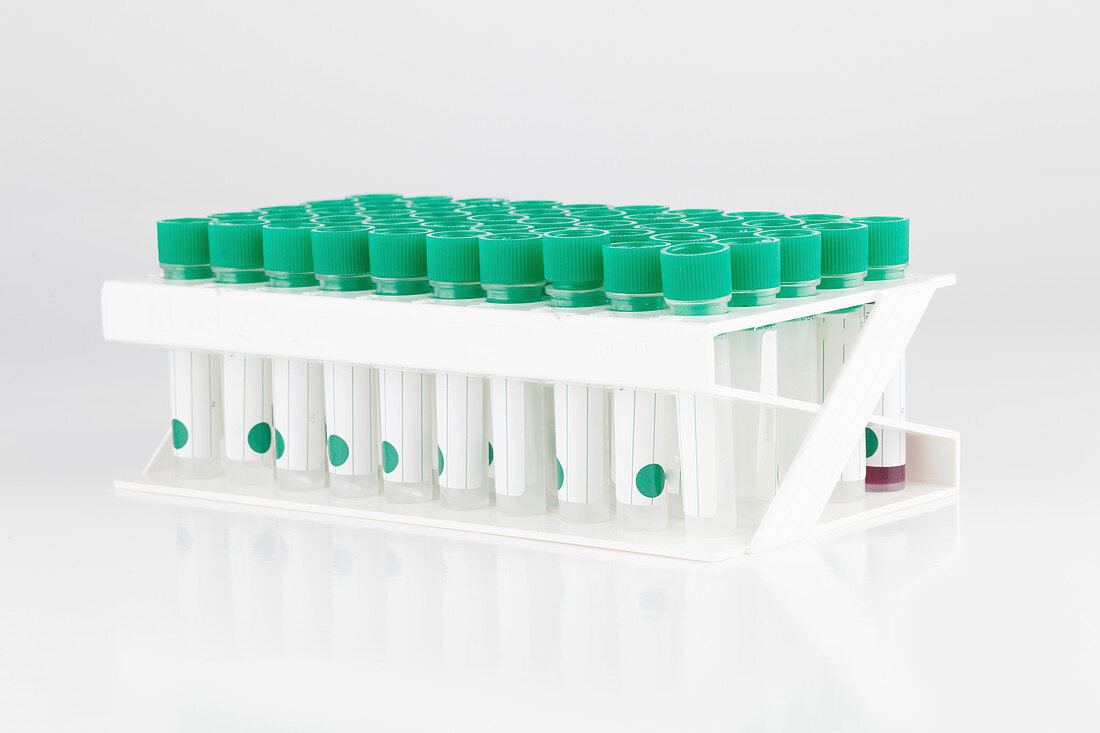 Plastic test tubes in rack