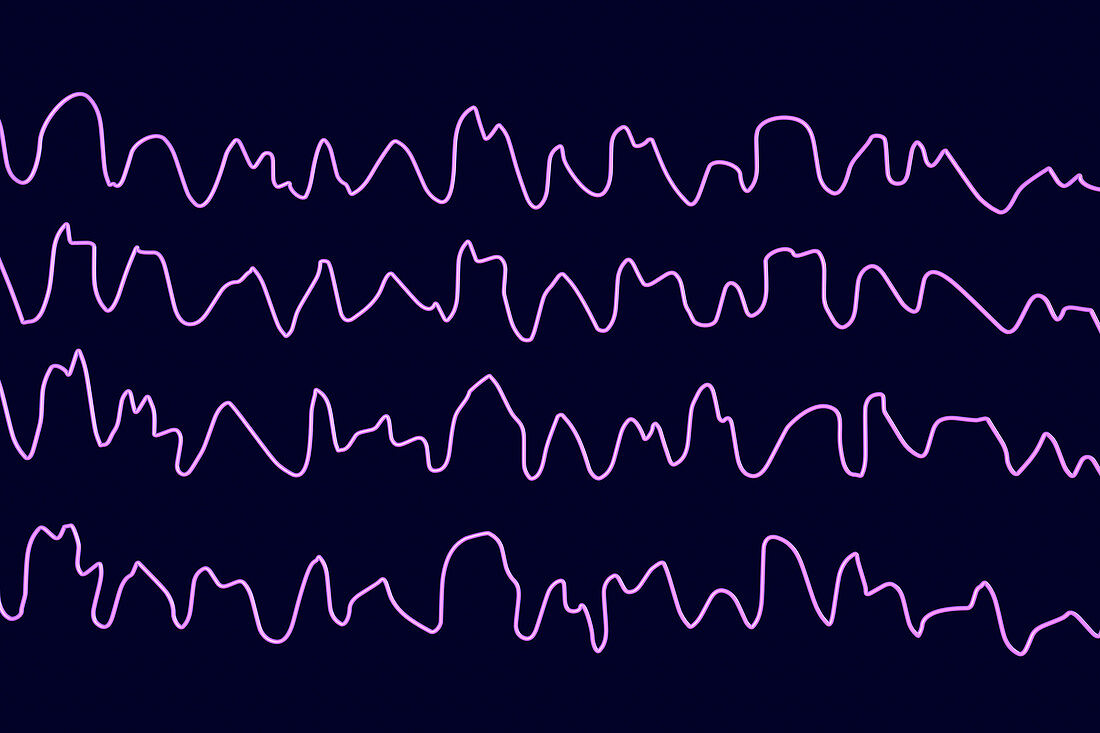 Brain waves during sleep, illustration