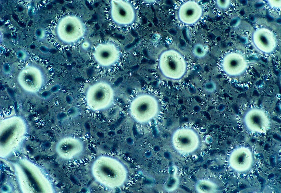 LM of cigarette smoke condensate