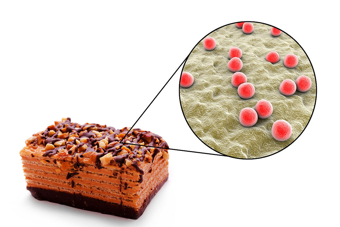 Staphylococcal food poisoning, conceptual illustration