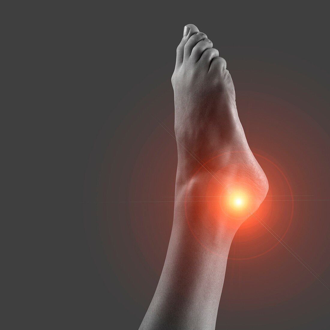 Ankle pain, conceptual image