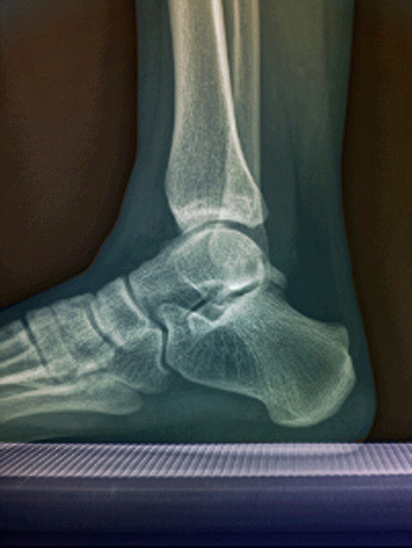 Human foot and ankle, lateral X-ray