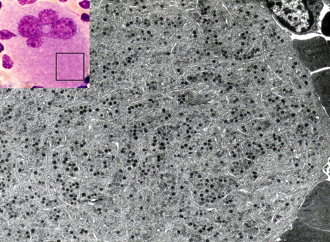 Megakaryocyte bone marrow cell, TEM