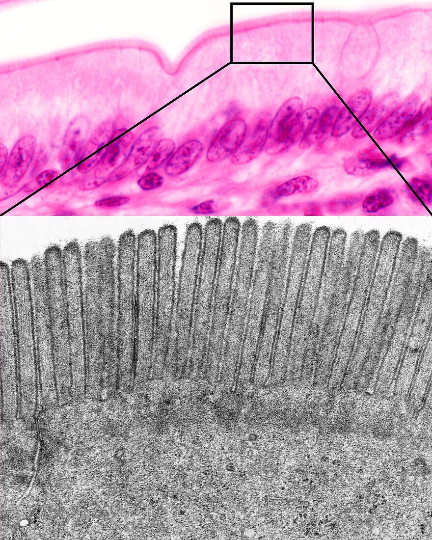 Intestinal brush border, micrographs