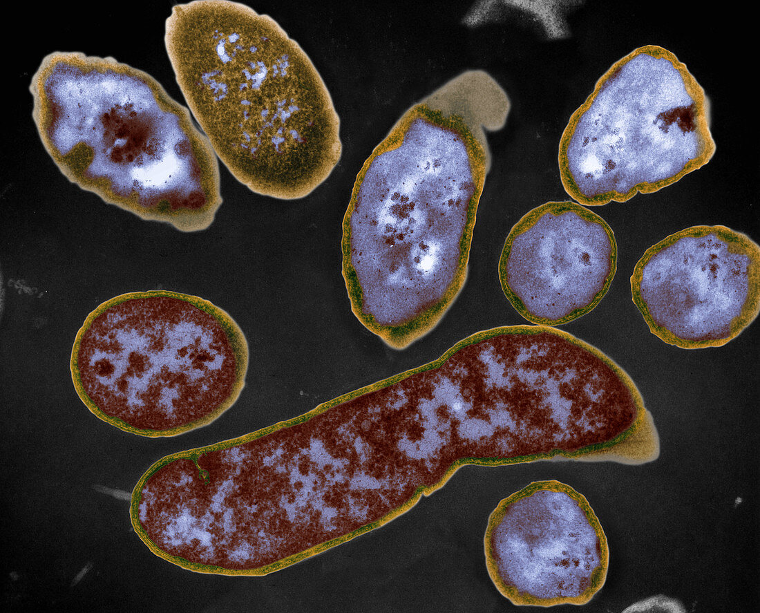 Coloured TEM of Vibrio cholerae bacteria