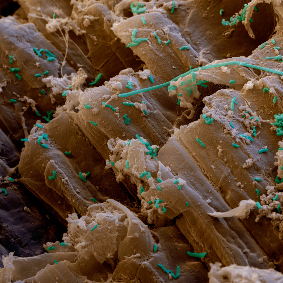 Essigbakterien 2800x - Essigsäure-Bakterien