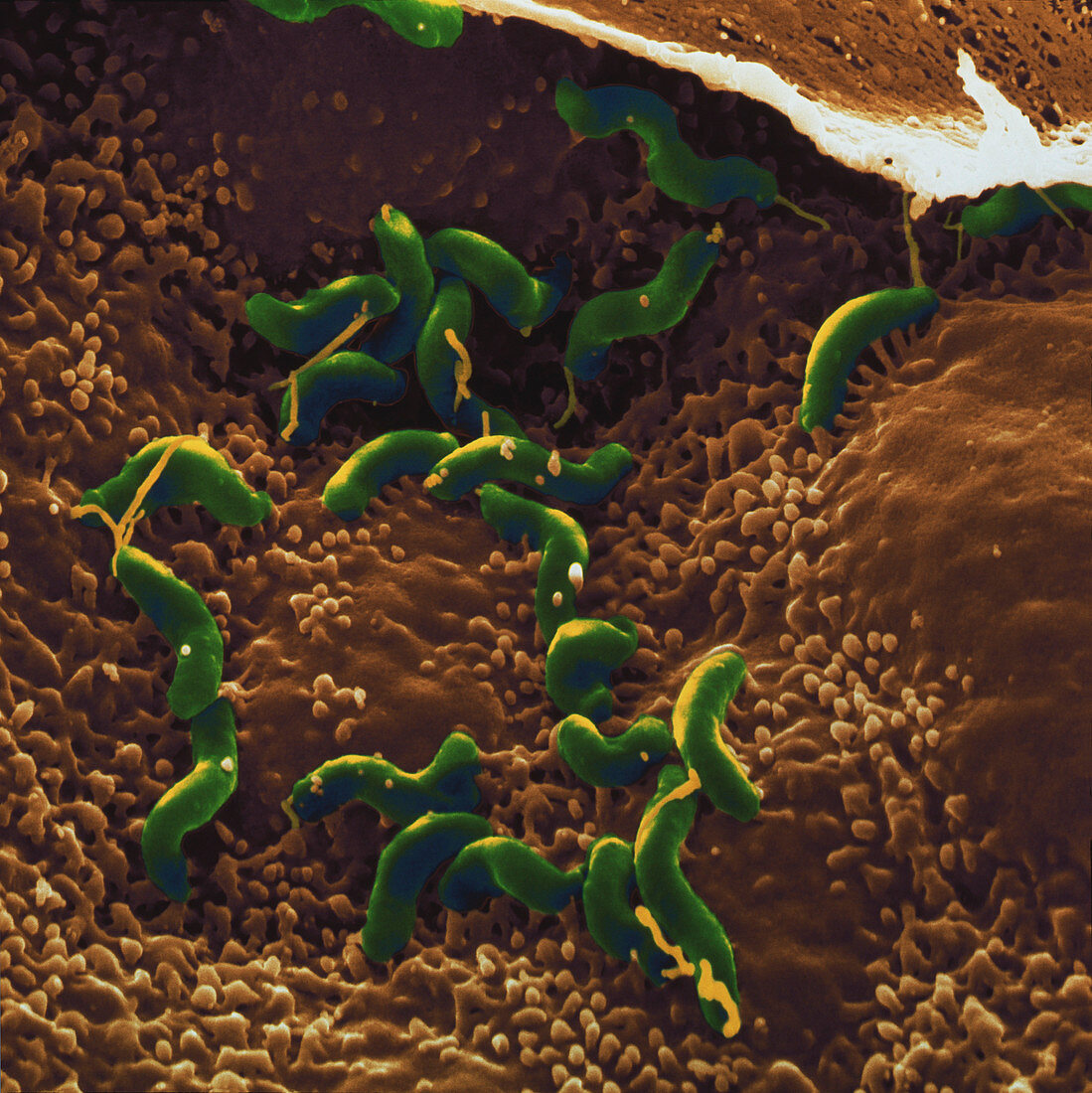 Helicobacter pylori bacteria