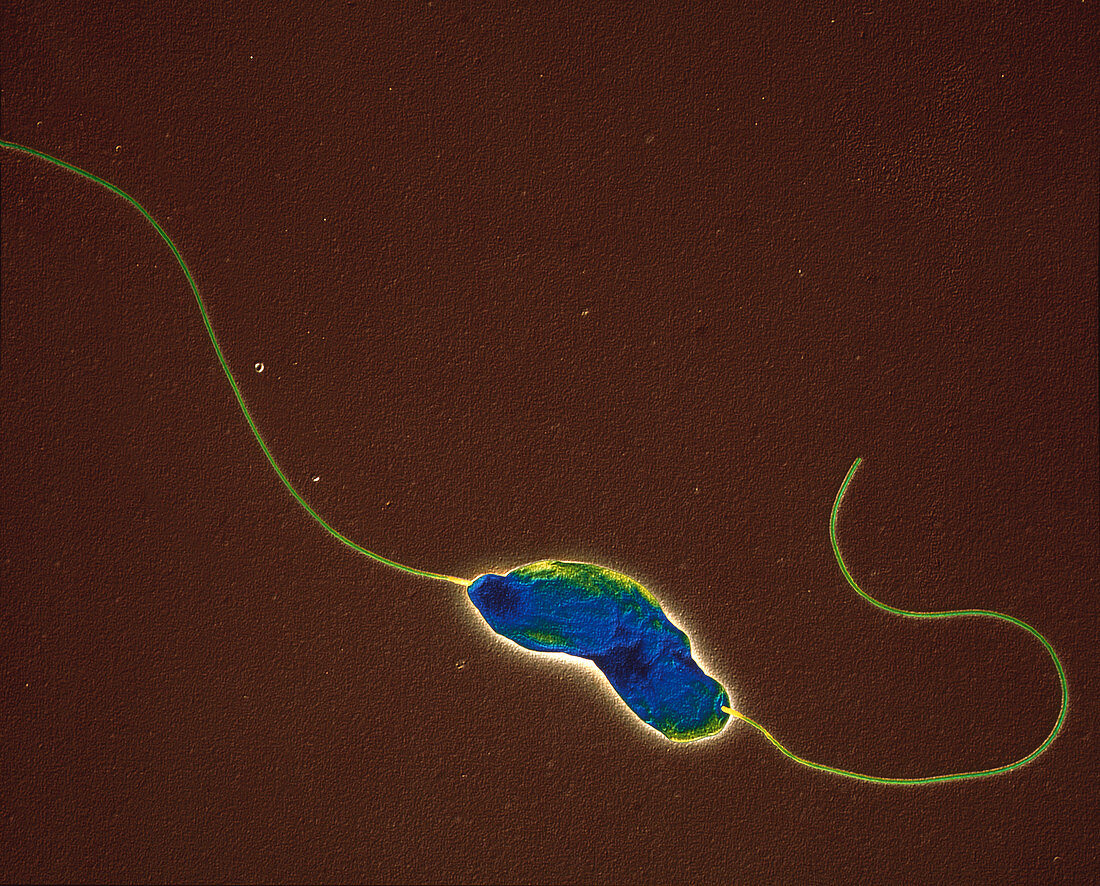 Campylob jejuni 25000x - Campylobacter jejuni