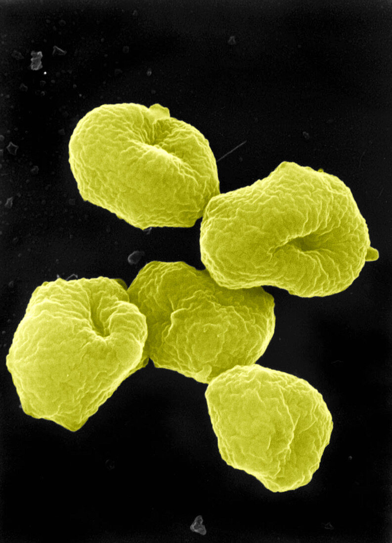 Sulfolobus archaea, SEM