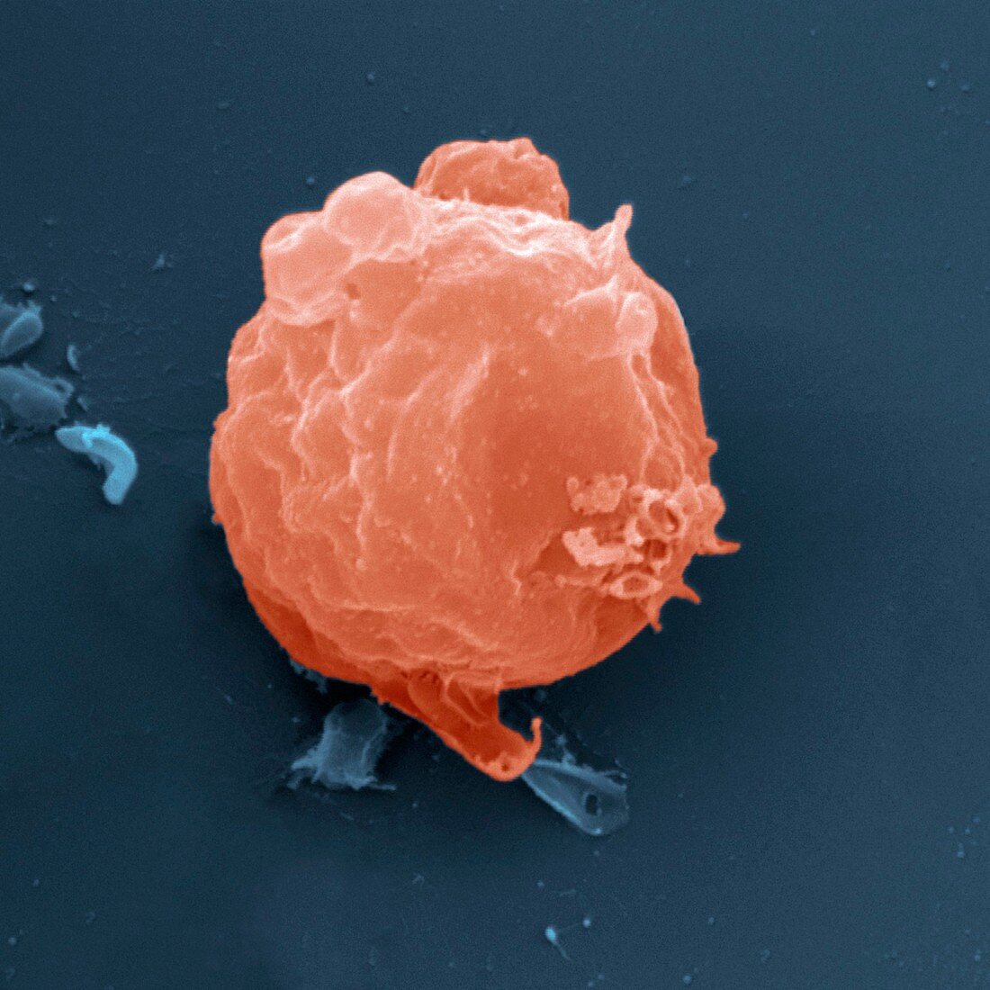Slime mould amoeba phase, SEM