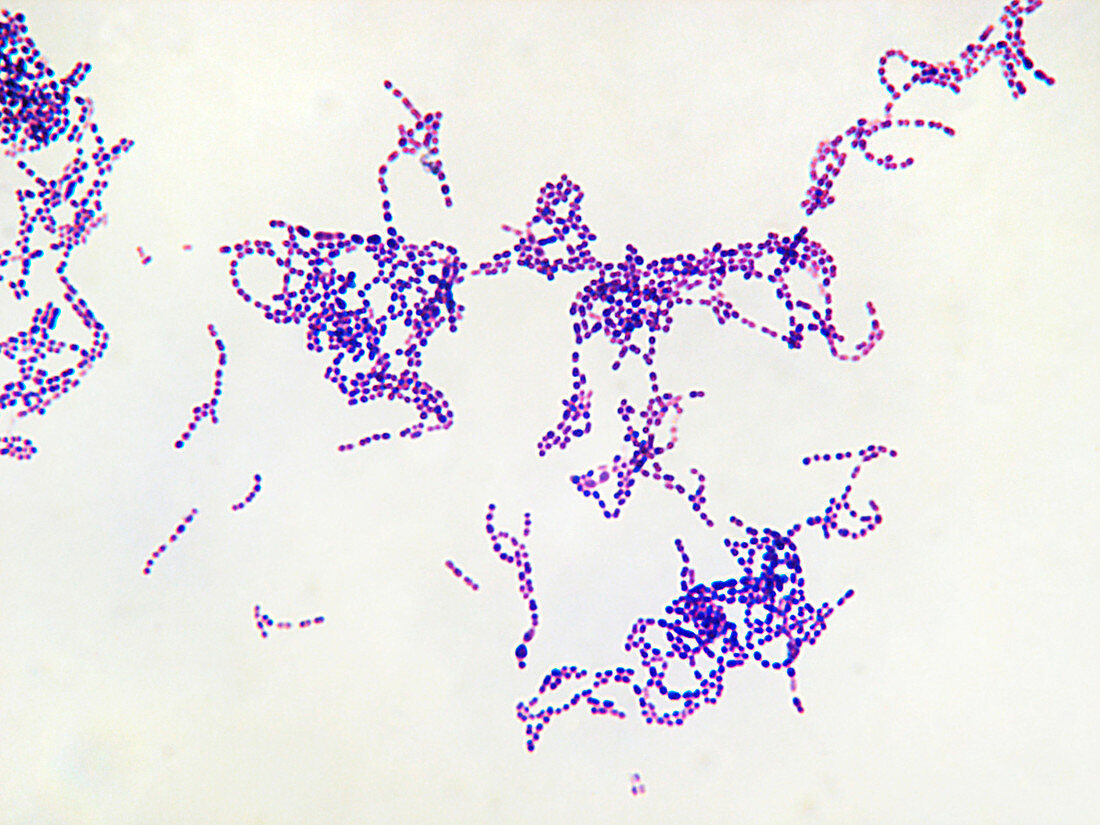 Streptococcus pyogenes bacteria