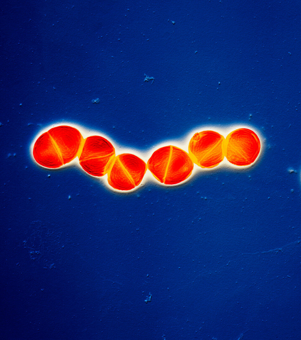 Streptococcus pneumoniae bacteria, TEM