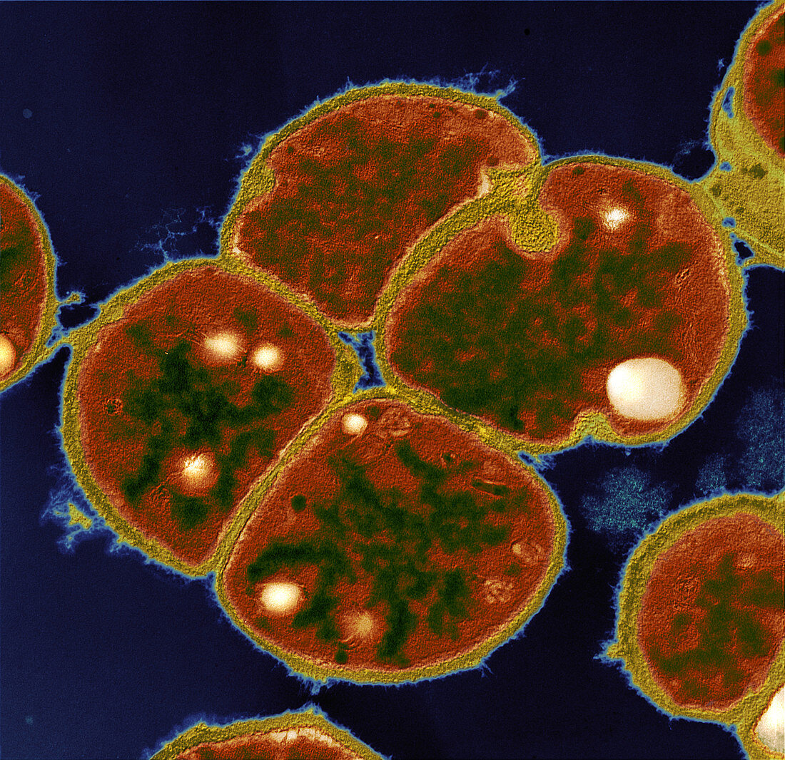 Halococcus morrhuae 25000x - Extremophile, Halococcus