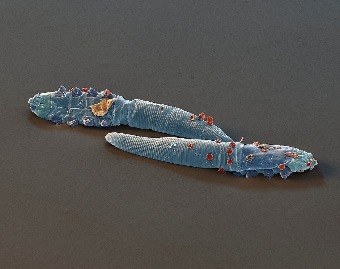 Eyelash mites, SEM