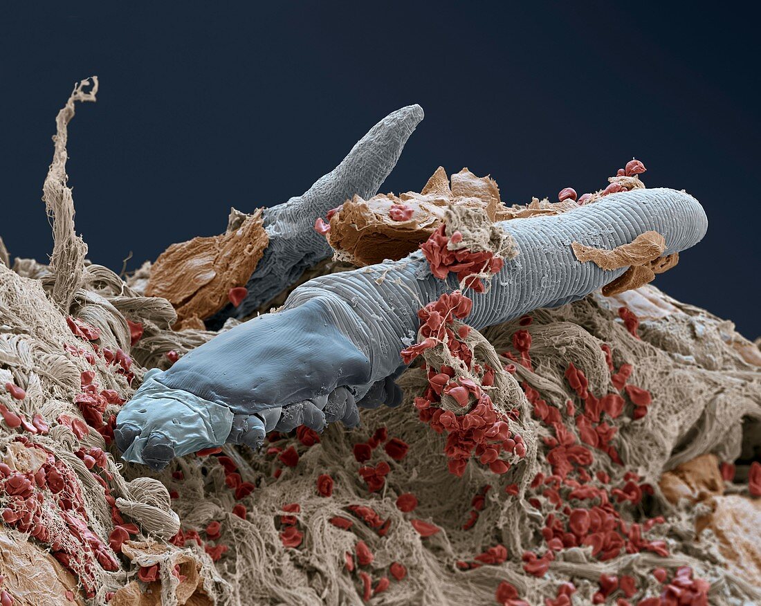 Demodex 800x - Demodex in Haut 800-1