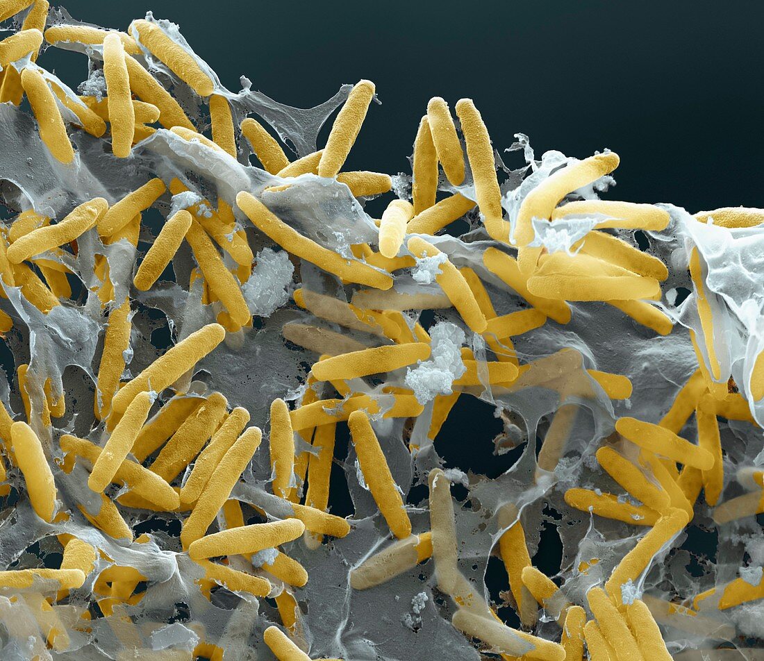 Myxococcus xanthus 10kx - Bakterien, Myxococcus xanthus 10 000-1