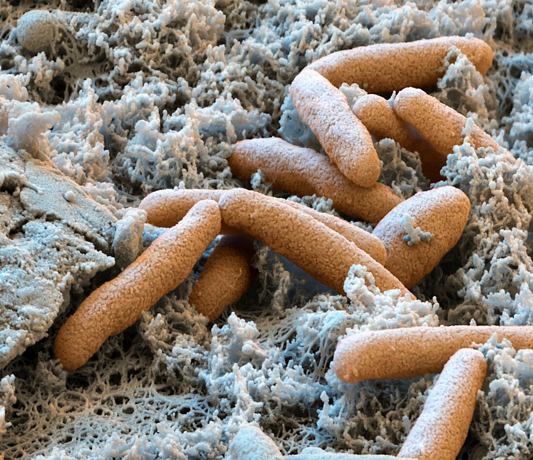 Myxococcus xanthus bacteria, SEM