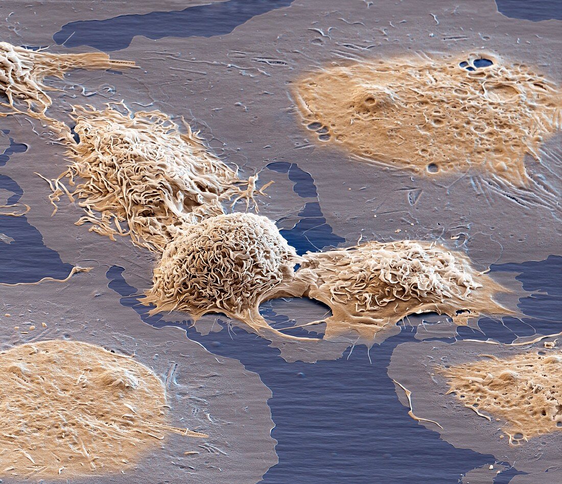THP-1 cells, SEM
