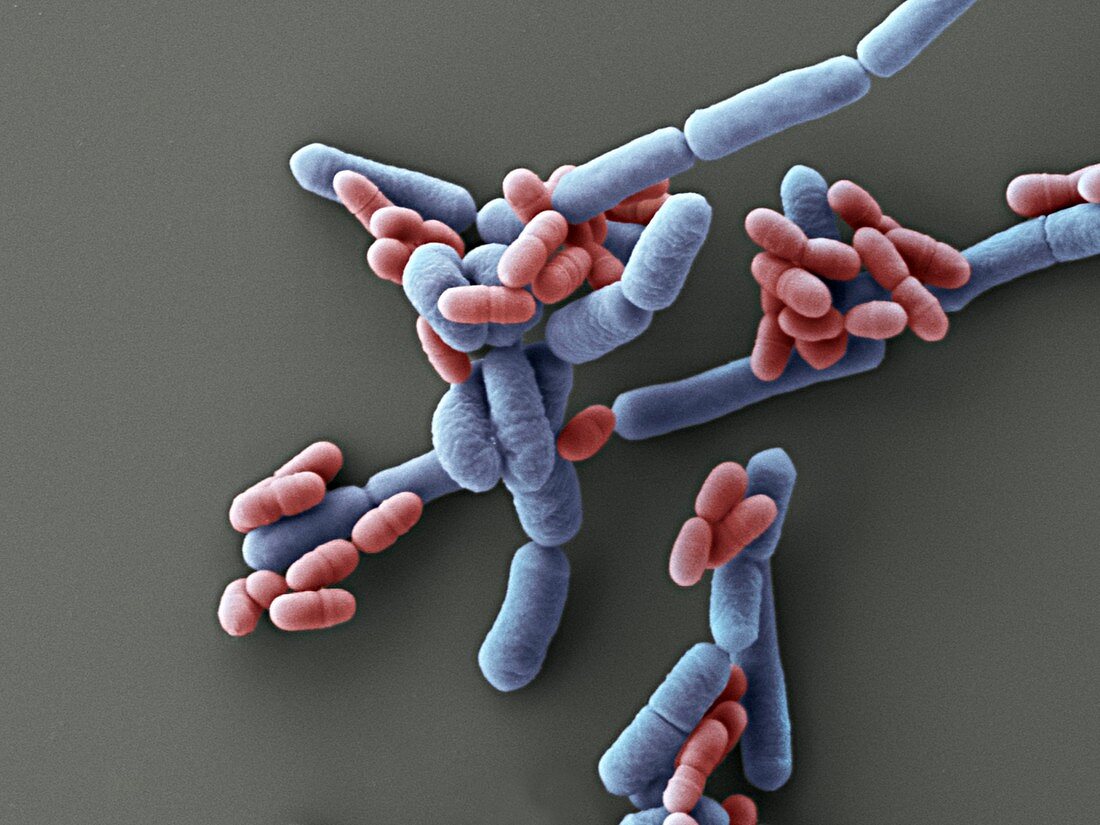 Lactobacillus paracasei bacteria, SEM