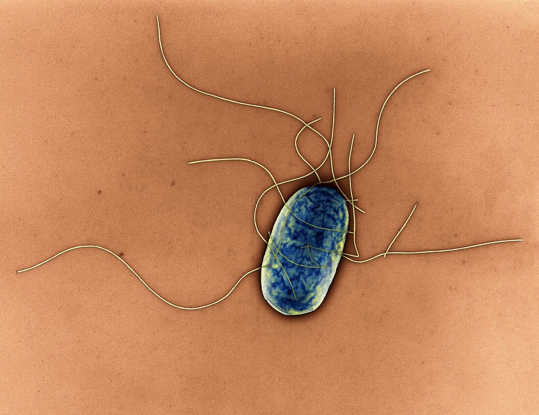 Salmonella typh 13000x - Salmonella typhimurium 13 000-1
