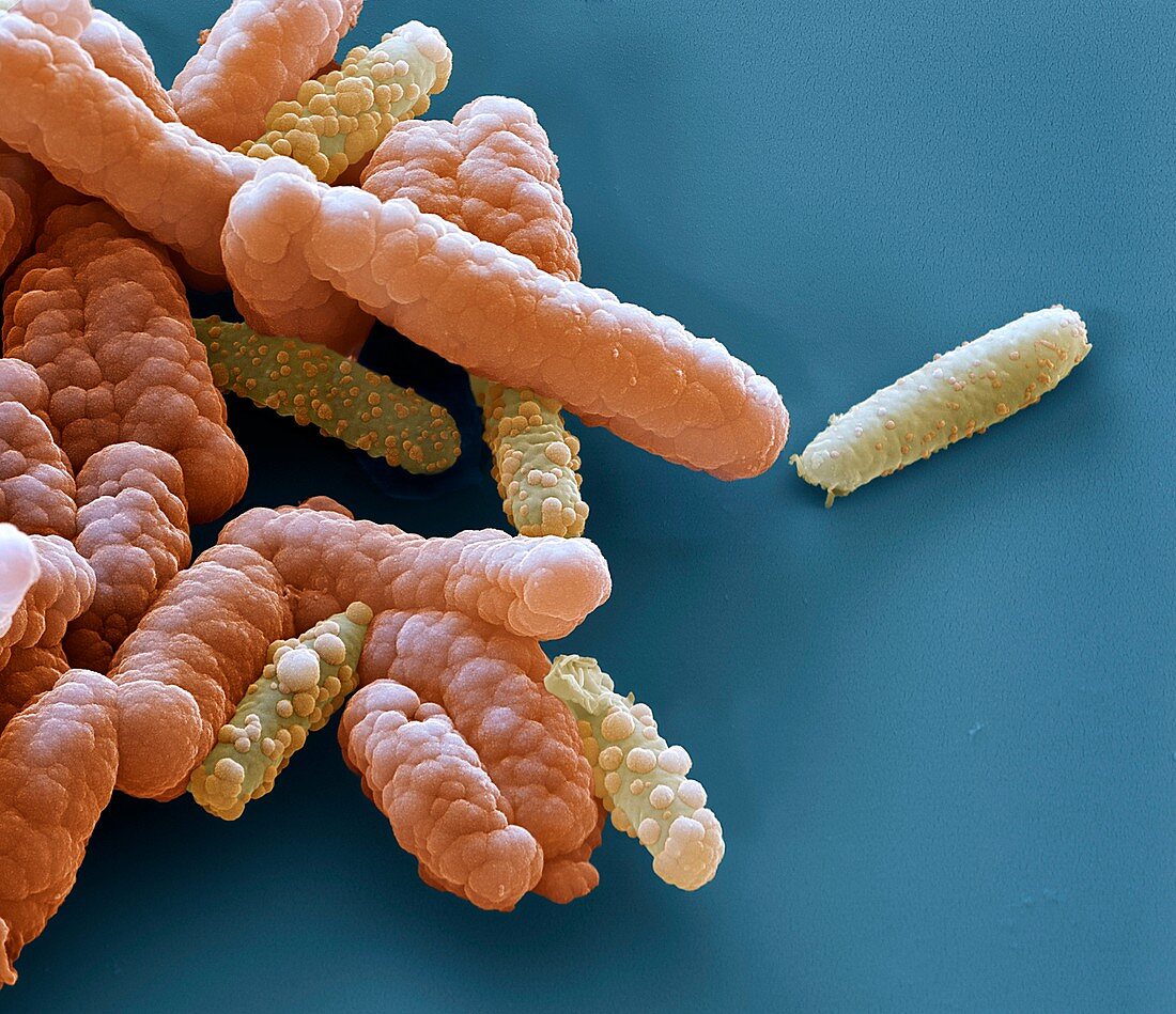 Acidovorax bacteria, SEM