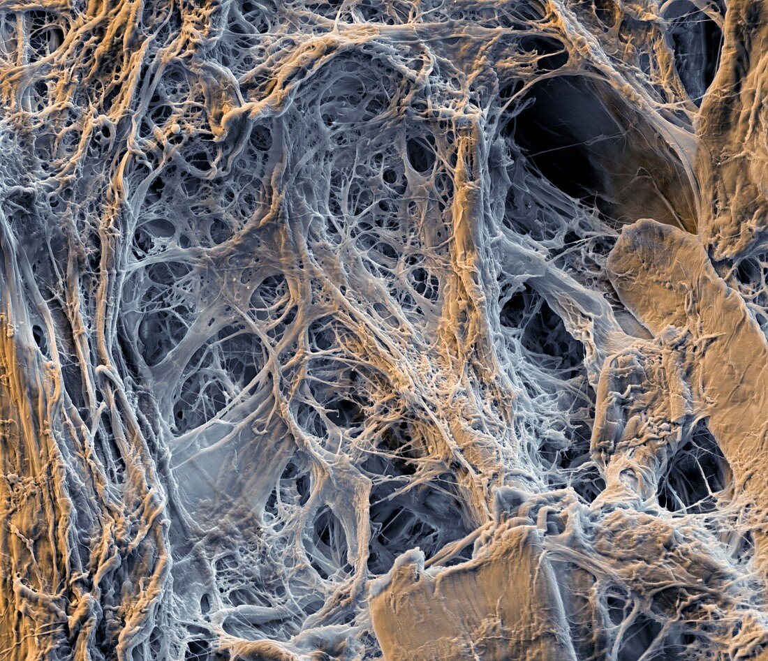 Nanocellulose mat, SEM